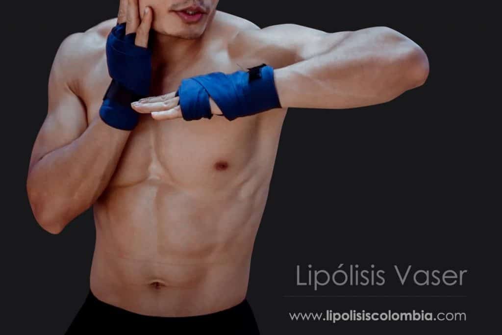 Lipólisis Ultrasónica