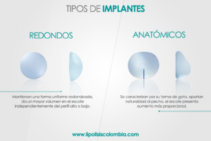 Implantes Mamarios según la Forma