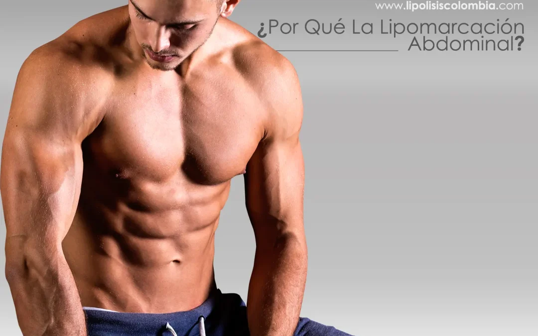 ¿Por qué cirugía definición abdominal hombres?